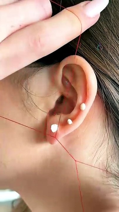 The truth about this ear hack