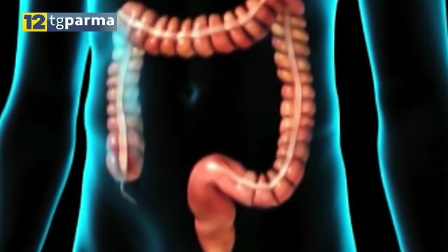 12 TV PARMA, ALLE 21 CHECK UP : FOCUS SULLE PATOLOGIE INTESTINALI | 12 TV PARMA, ALLE 21 CHECK UP : FOCUS SULLE PATOLOGIE INTESTINALI