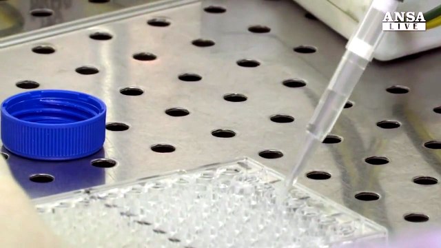 Usa, ok a terapia genica per malattia rara della retina