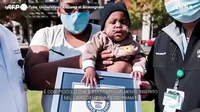 Negli Usa record di sopravvivenza per il neonato piu' prematuro al mondo
