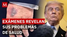 ¡Alerta en la Casa Blanca! Trump presume "inteligencia extrema" y revela su estado de salud actual