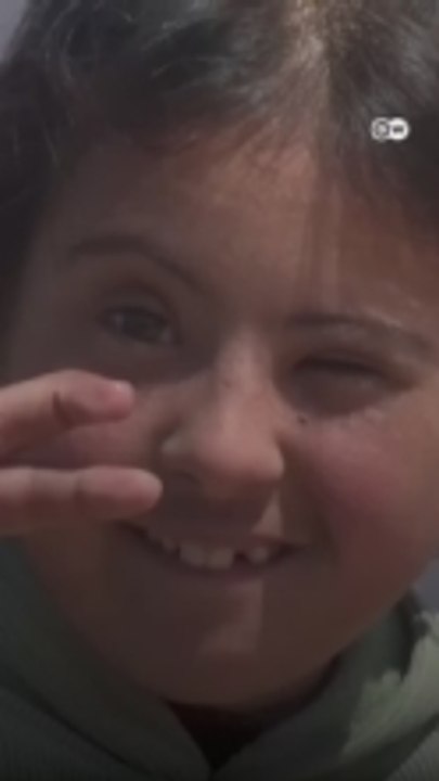 أطفال متلازمة داون في غزة ما زالوا يخوضون حربًا أخرى لا يراها أحد