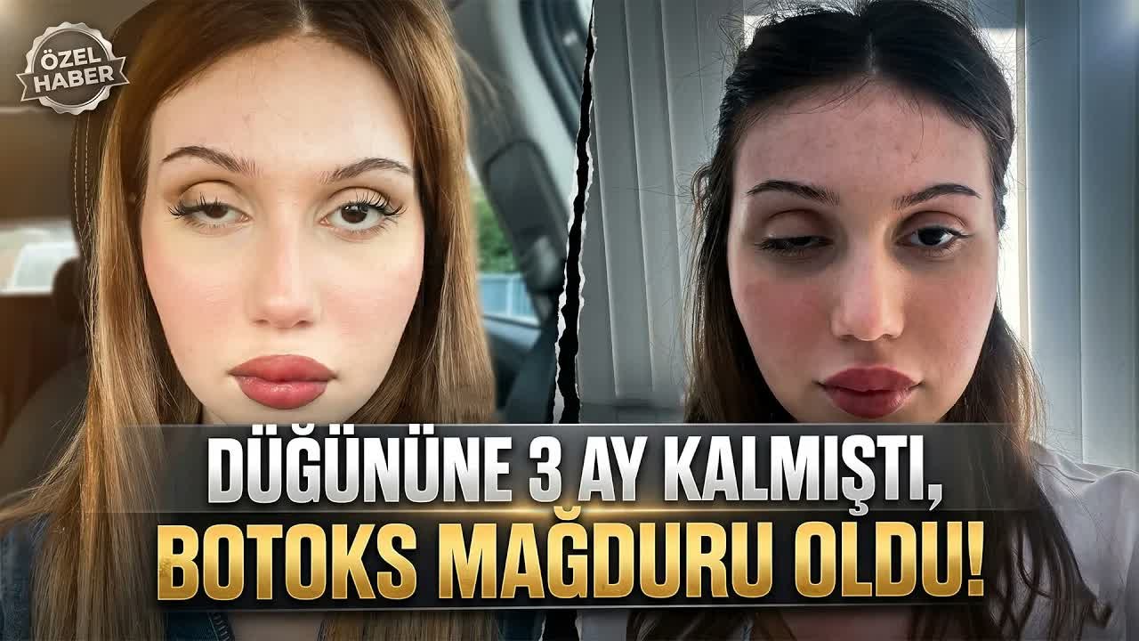 Botoks yaptıran kadının işlem sonrası göz kapağı düştü