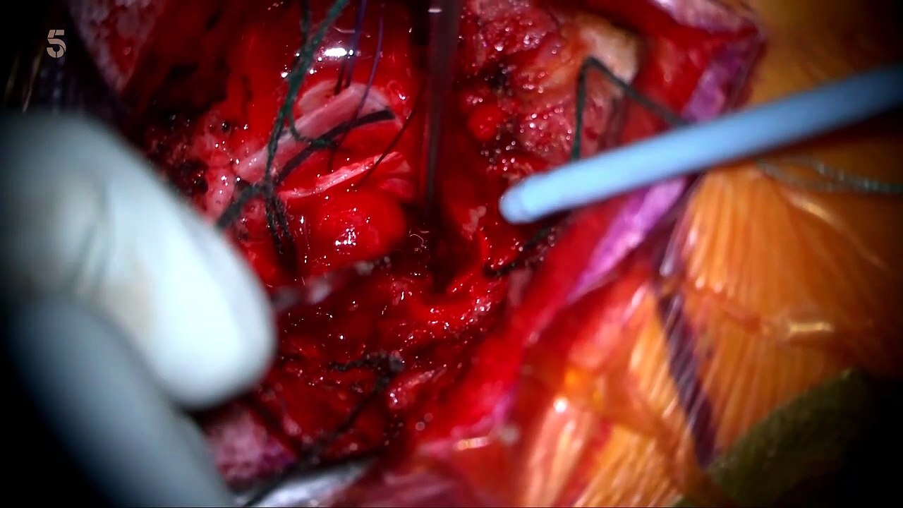 Trauma Room One S02E06 [Full Movie]