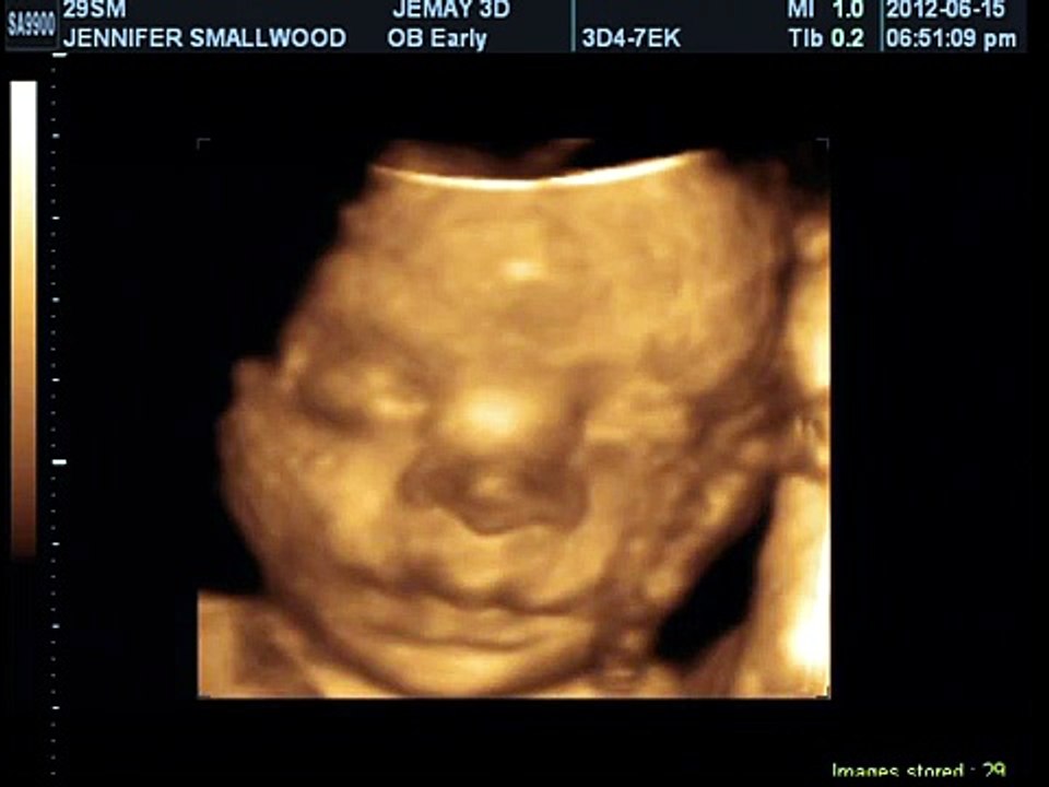 LOGAN MICHAEL XAVIER 3D SONOGRAM JUNE 15 2012