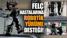 Felç Hastalarının Tedavisinde Robotik Sistem Kapasitesi Artırıldı