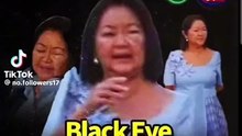 Philippines First Lady Liza Marcos got a Black Eye - What happened? [Full Movie]