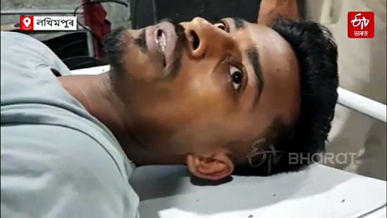 আৰক্ষীৰ জিম্মাৰ পৰা পলাবলৈ চেষ্টা কৰোতেই ভৰি ভাঙিল অভিযুক্তৰ