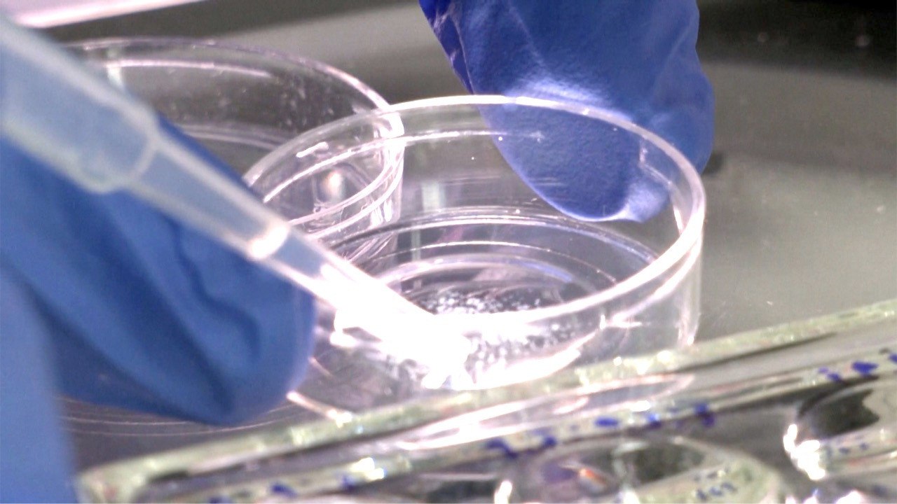 In 2023, Israeli scientists grew the world's first synthetic human embryo without eggs or sperm