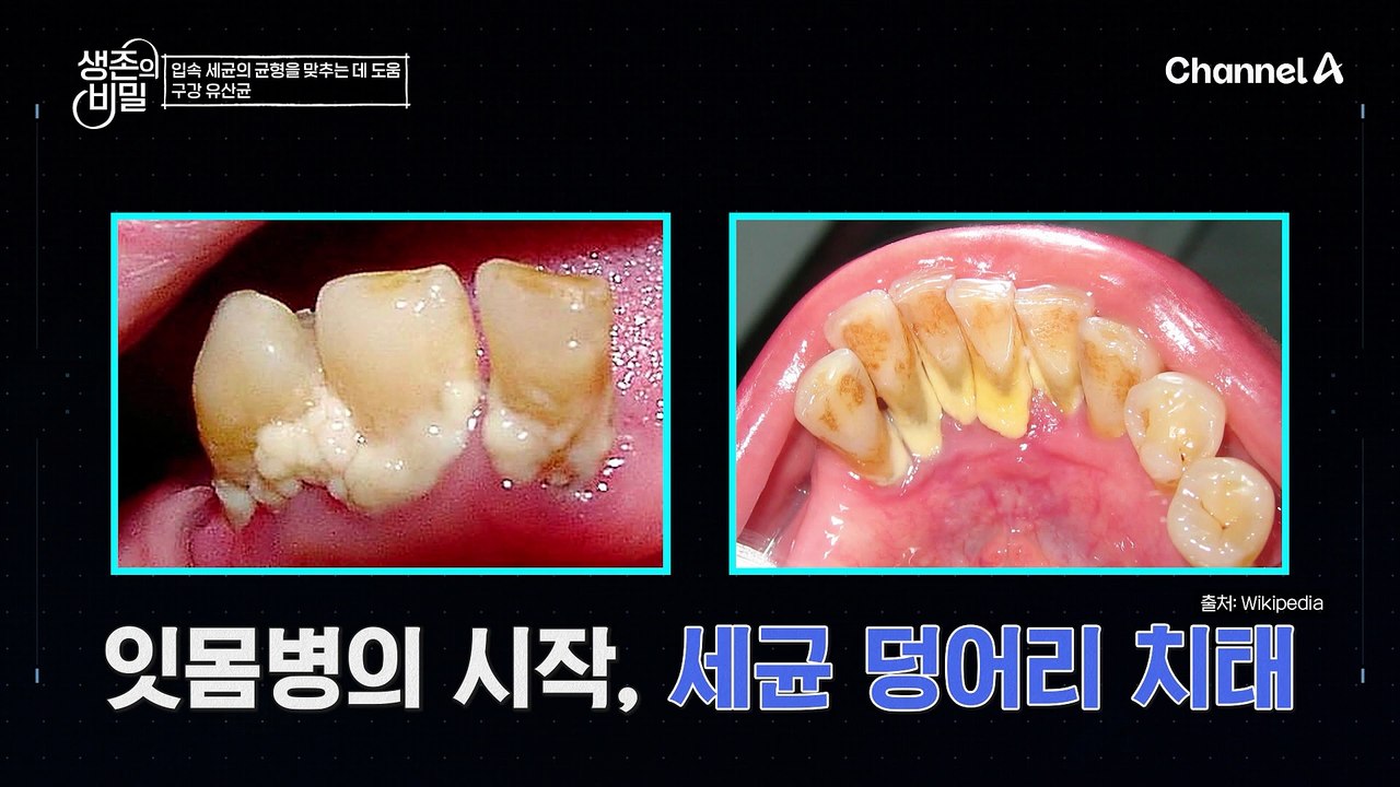 장은 장내 유산균! 입은 구강 유산균! 입안 환경에 특화된 구강 유산균 M18