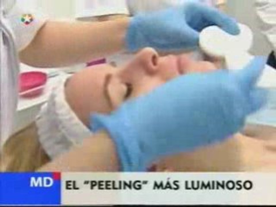 Peeling_Luminoso Imestetico