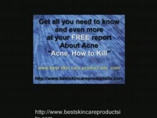 learn how to get rid of acne and have simple home remedies