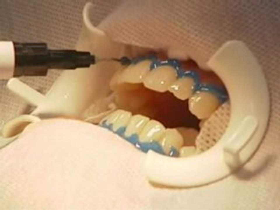 TEETH WHITENING
