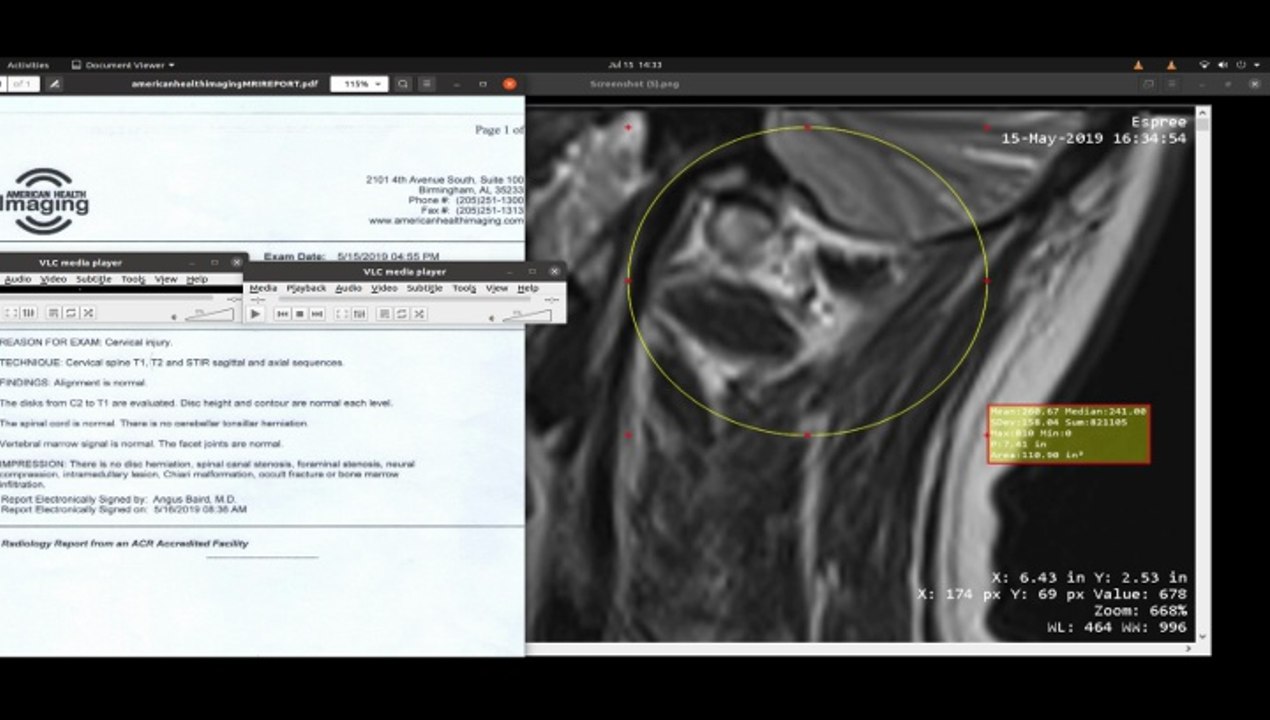 My Christ Health CEO Dr. Robert Record MD Call: NP Ascribed Injury (Broke Skull) To Psych Etiology