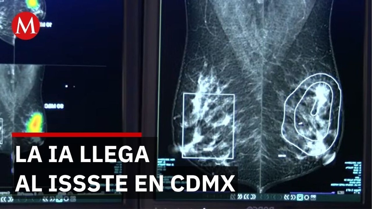 IA detecta tumores menores a 2 milímetros impalpables para diagnóstico temprano de cáncer