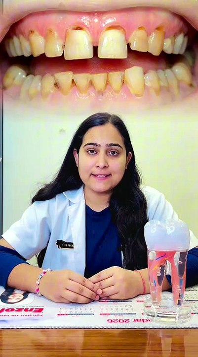 What Causes Tooth Decay? | Why Do Teeth Get Damaged? | Triveni Dental