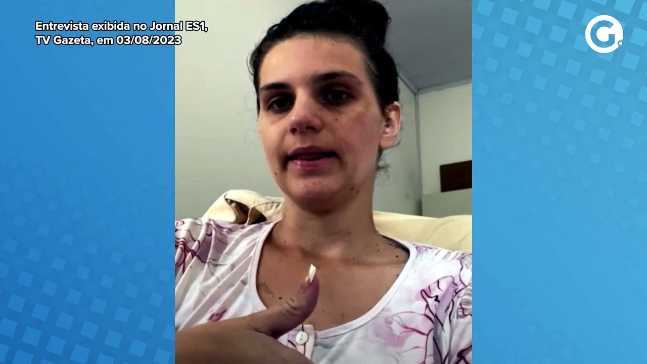 Influencer queimada em churrasco tem alta após quase 2 meses no ES