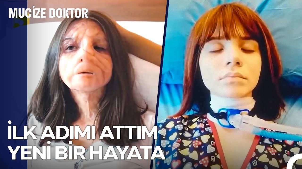 1 Bölüm 1 Vaka; Bambaşka Bir Yüz Bambaşka Bir Hayat - Mucize Doktor