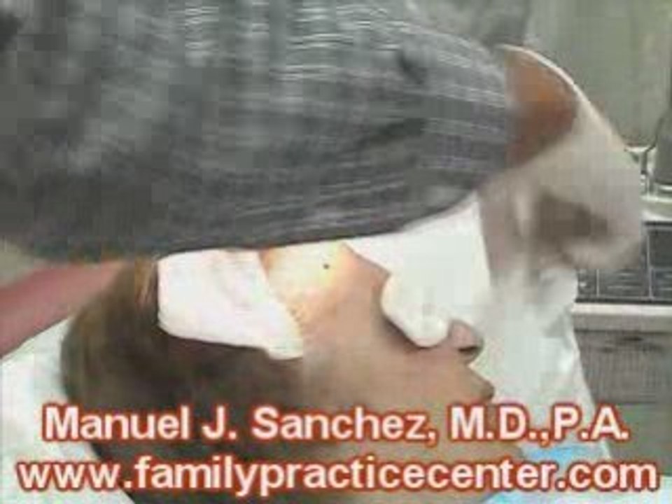 Laser Surgery Removing a Skin Lesion