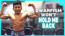 My Rare Dwarfism Is 1 In 150,000 | BORN DIFFERENT