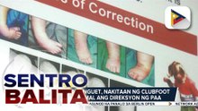 Isang sanggol sa Benguet na nakitaan ng ‘clubfoot’ nang ipinanganak, normal na matapos ang isang buwan na intervention | ulat ni Brigitte Marcasi ng PTV Cordillera