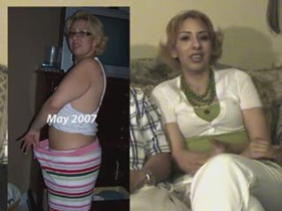 Bariatric Surgery in Mexico