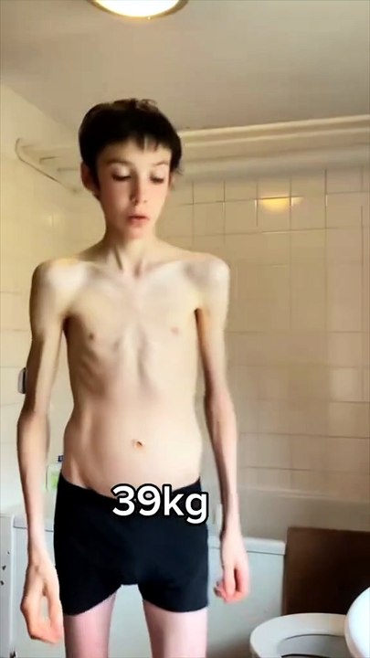 The best transformation I have ever seen !! 😱