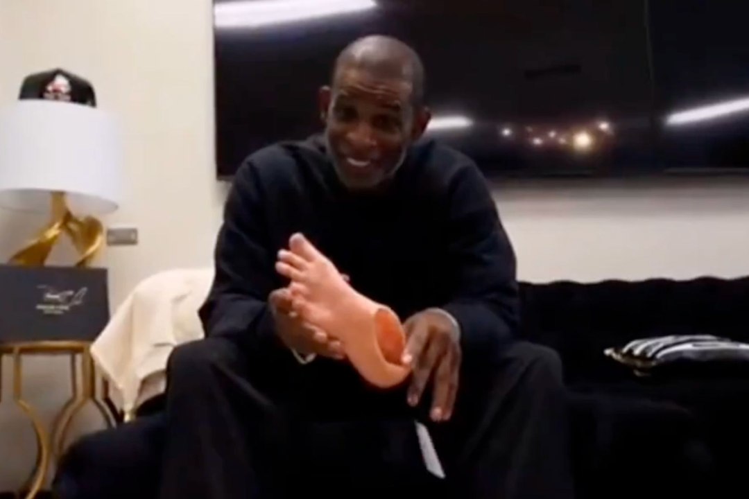 Coach Prime gets new prosthetic toes then spots a brand-new problem