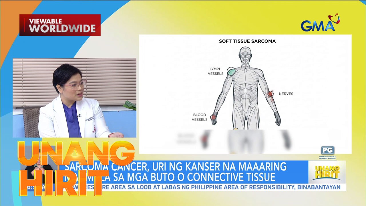 UH Clinic - Usapang cancer, paano ito maagapan? | Unang Hirit