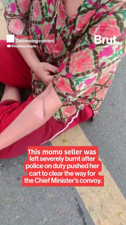Momo seller gets burn injuries after police action causes hot water to fall on her