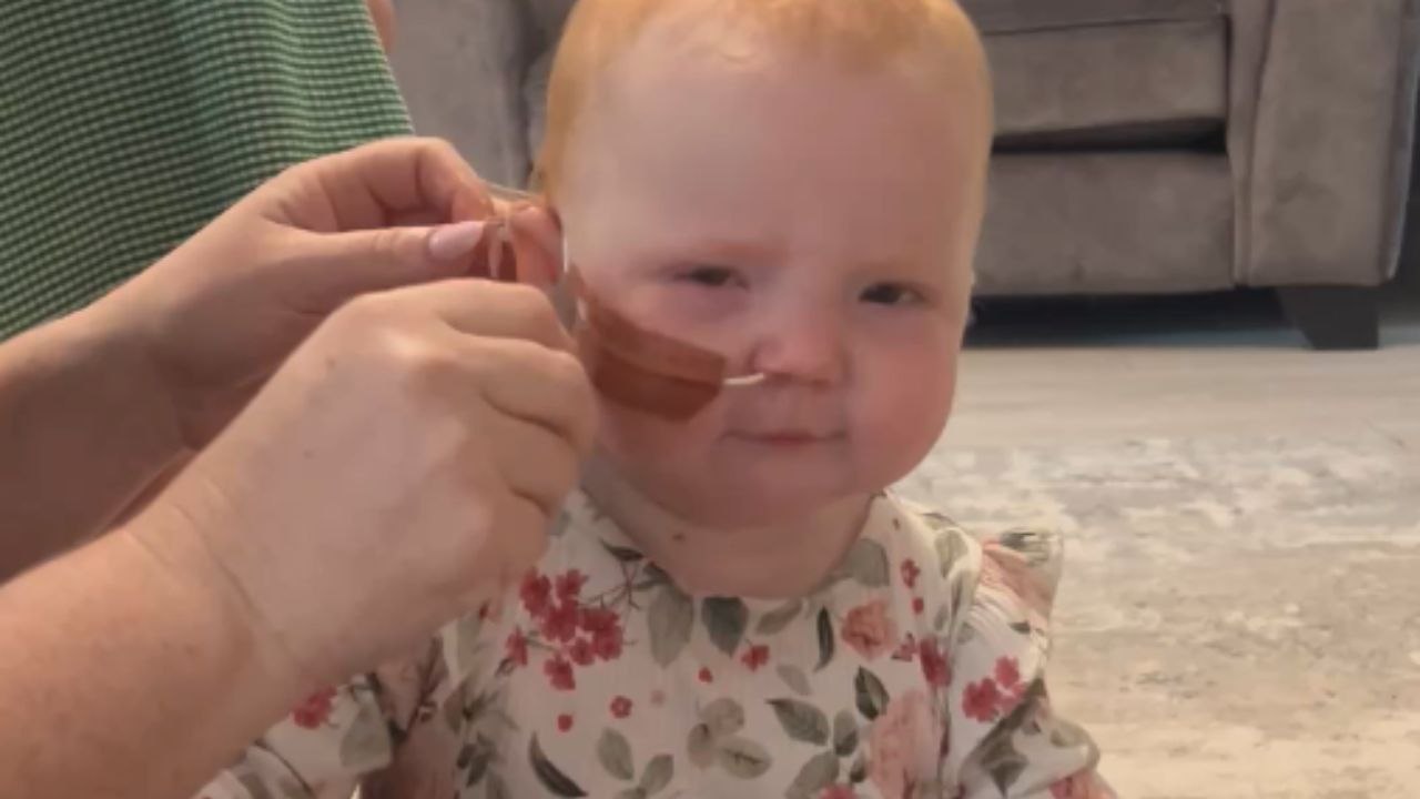 Baby Amelie Triumphs Over Pierre Robin Sequence as Feeding Tube is Removed