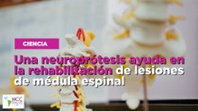 Una neuroprótesis ayuda en la rehabilitación de lesiones de médula espinal