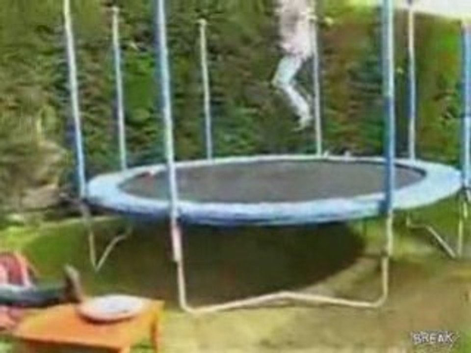 Broken Leg Off Trampoline