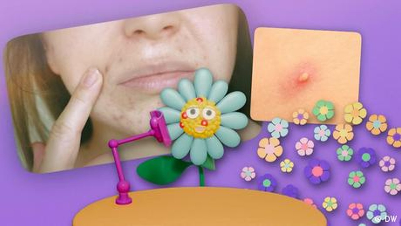 Pimples? Don’t Pop! Go Plant Mode!