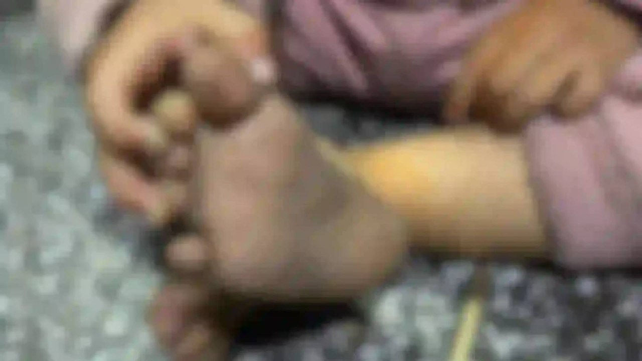 Medicina Legal reveló las torturas que sufrió un niño antes de ser asesinado por su madre en Medellín