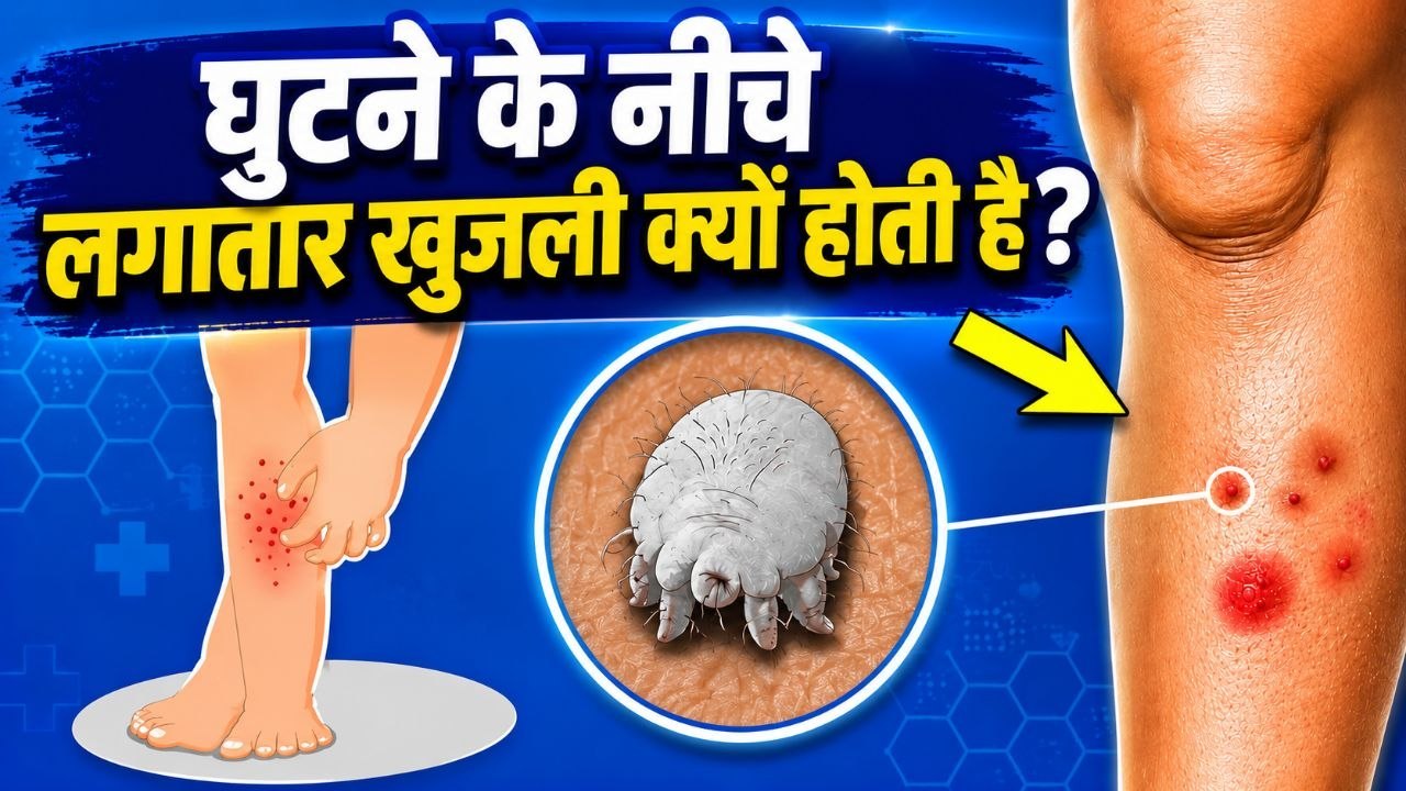 Ghutne Ke Niche Khujli Hona: घुटने के नीचे खुजल...