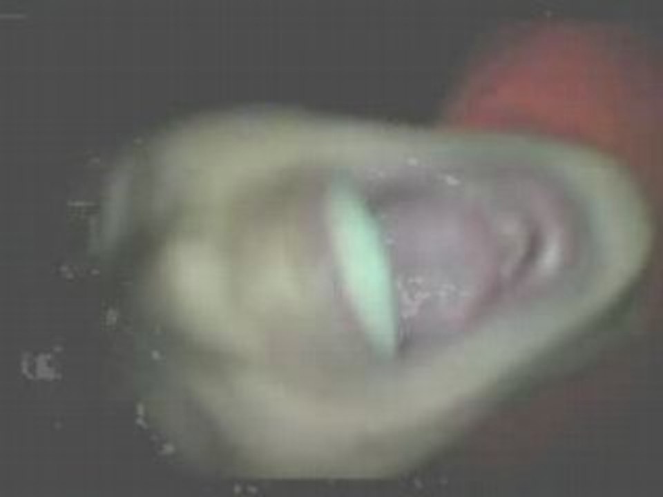 3 Tage Wach lützelkirchen 1 bei stonie