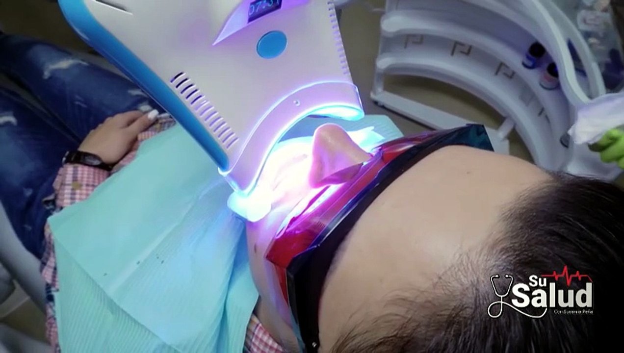 Su Salud: Odontólogo responde principales dudas sobre blanqueamiento dental [Full Movie]