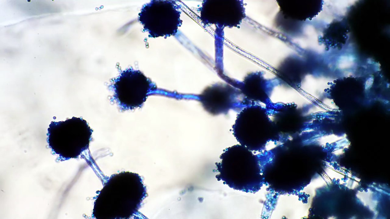 The Hidden Underground Web That Connects Trees