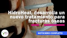 HidroHeal, desarrolla un nuevo tratamiento para fracturas óseas| 310| 13 de julio al 19 de julio