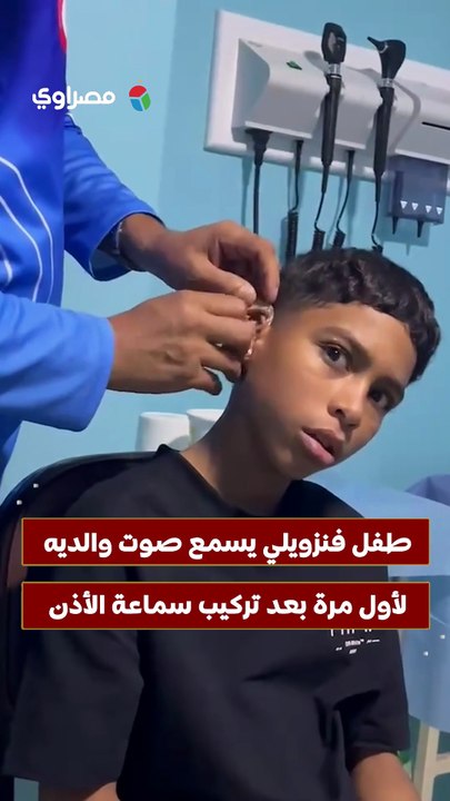 طفل فنزويلي يسمع صوت والديه لأول مرة بعد تركيب سماعة الأذن