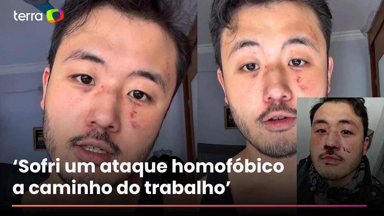 Professor espancado no metrô de SP afirma ter sido vítima de homofobia: ‘Buscar justiça não é fácil’