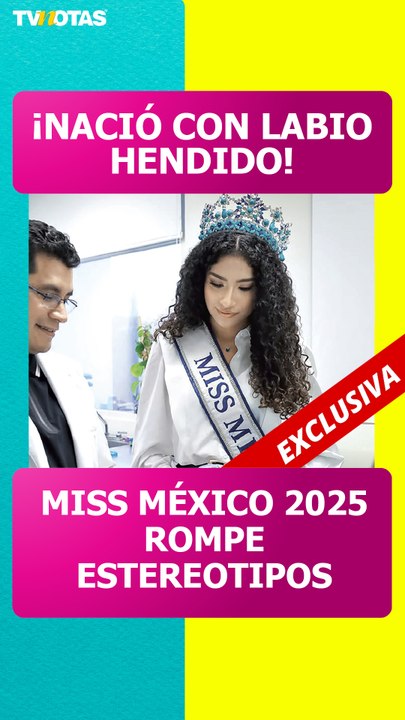 Miss Universo México 2025 rompió el silencio: Cassandra García revela cómo superó el labio y paladar hendido