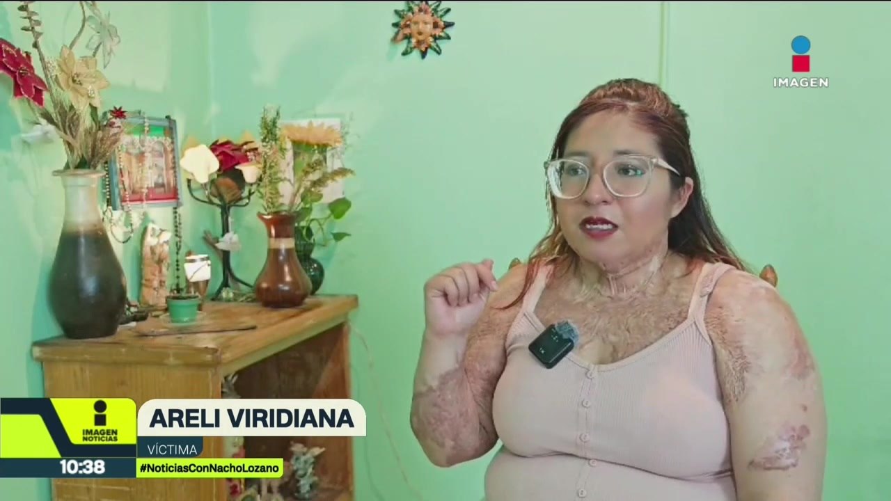 Van dos años y Areli sigue esperando justicia; su ex le roció alcohol y le prendió fuego