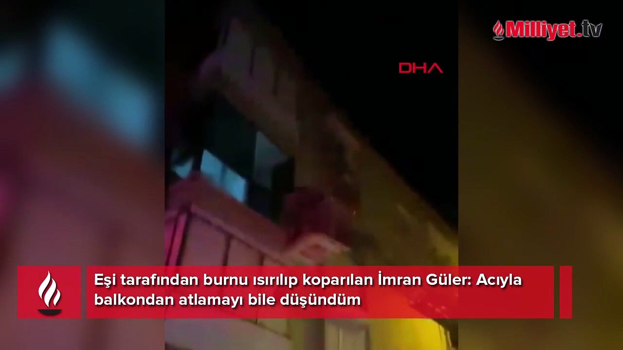 Eşi tarafından burnu ısırılıp koparılan İmran dehşeti anlattı: Acıyla balkondan atlamayı düşündüm