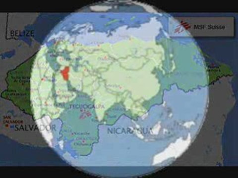 Médecins Sans Frontières - Camps de réfugiés Part 1/5