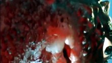 5 怪獣バドラ誕生す