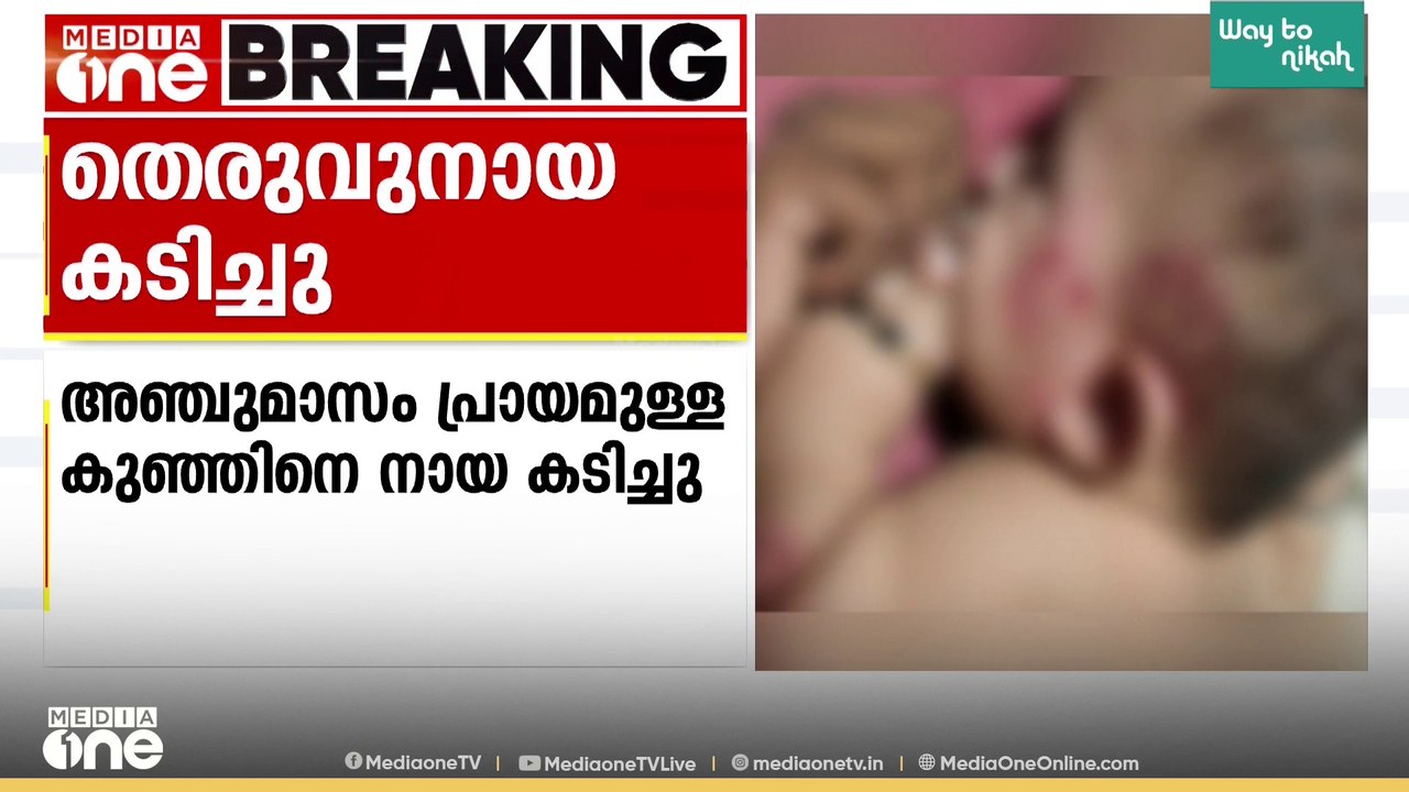 അതിദയനീയം; വീട്ടിനകത്ത് ഉറങ്ങുകയായിരുന്ന അഞ്ചു മാസം പ്രായമുള്ള കുഞ്ഞിനെ തെരുവ് നായ കടിച്ചു...