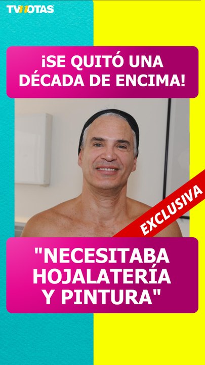 ¡Se quitó 10 años de encima! Así luce Julio Camejo tras someterse a proceso estético