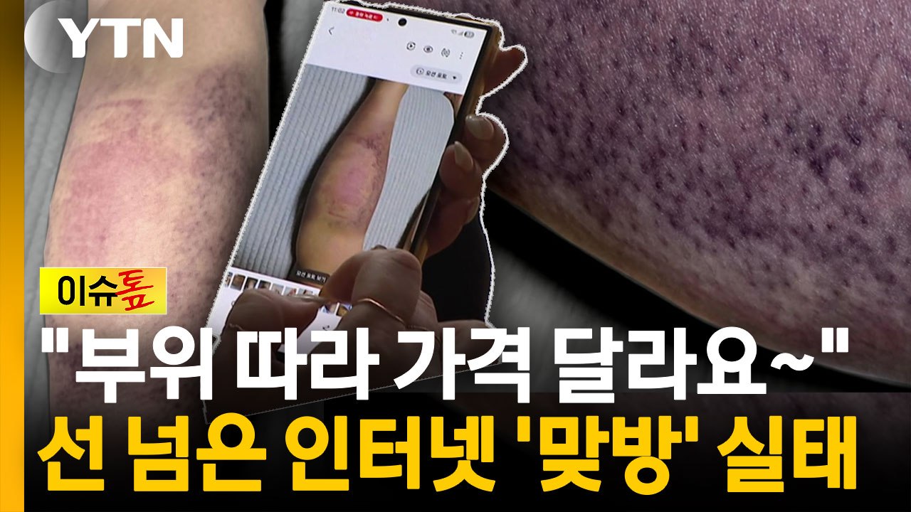 "어디 때릴지 골라주세요"...'8시간에 1,300대' 부위 가격표까지 [이슈톺] / YTN